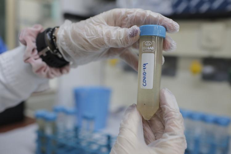 COVID19, Λύματα, κορωνοιός 